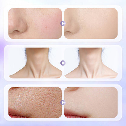 🔥Solange der Vorrat reicht 40 % Rabatt!🎉Langanhaltende, leichte Gesichtscreme für strahlende, aufgehellte Haut