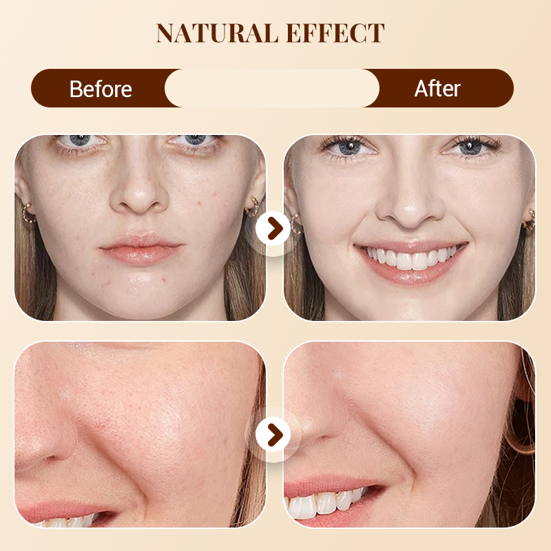 🔥LETZTER TAG DES SONDERVERKAUFS⚡ÜBER 50.000 VERKAUFT!💝Soft Matte Cream Concealer-Palette mit 8 Farbtönen