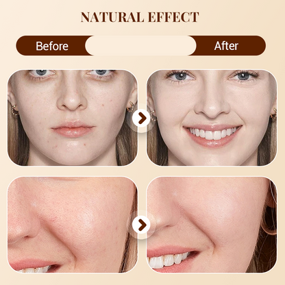 🔥LETZTER TAG DES SONDERVERKAUFS⚡ÜBER 50.000 VERKAUFT!💝Soft Matte Cream Concealer-Palette mit 8 Farbtönen